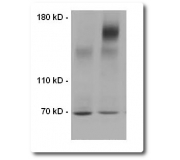 Transmembrane Protein Extraction Reagent (Part No. tmPER-50;  Plasma Protein Isolation)